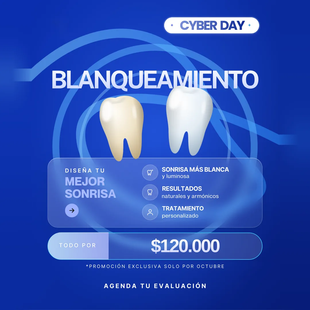 Cyber Day ProDental: Blanqueamiento todo por $120.000. Sonrisa más blanca, resultados naturales y tratamiento personalizado. Promoción exclusiva de octubre.