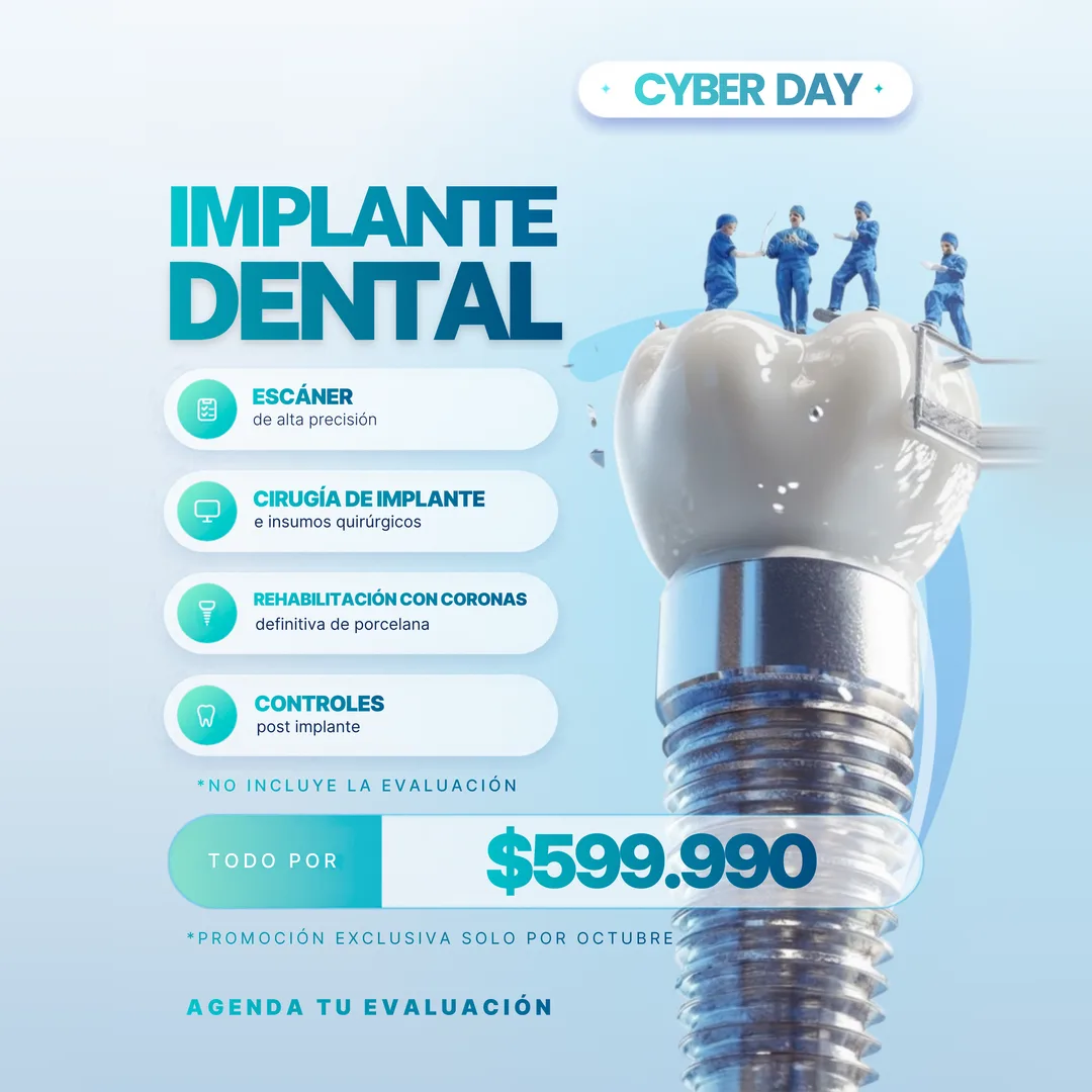 Cyber Day ProDental: Implante Dental todo por $599.990. Incluye escáner, cirugía, corona de porcelana y controles. Promoción exclusiva de octubre.