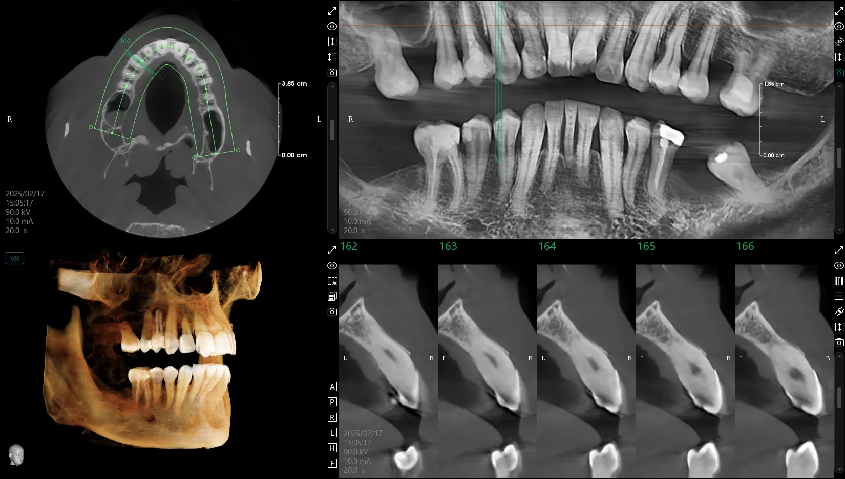 Radiología Digital